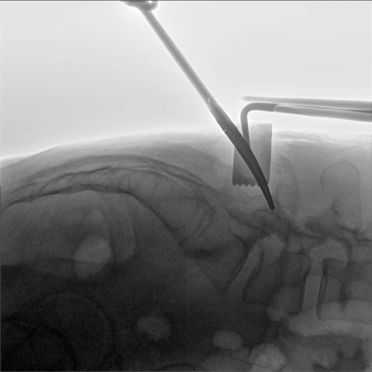 Rotational Orthopedic C Arm Machine